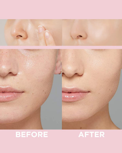 TOUCH IN SOL No Poreblem Primer – Pore Primer for Korean Makeup, Mattifying Primer for Oily Skin, Pore Eraser for Large Pores, Blurring Finish from K Beauty (1.01 fl.oz/30ml) Touch in SolBuy Supplements Australia
