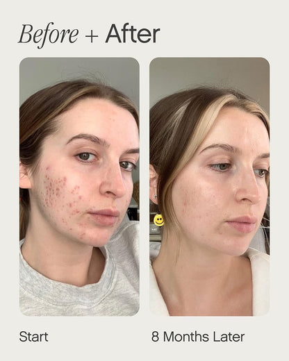Topicals Faded Brightening and Clearing Serum | Reduces Discoloration, Post-Blemish Marks, Scars and Spots