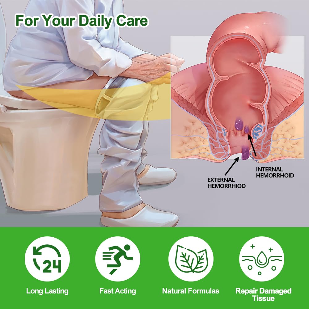 RHAICARE Hemorrhoid and Fissure Treatment Cream,Hemorrhoidal Ointment for Fast Acting Itch, Swelling, and Maximum Strength Pain Relief RHAICAREBuy Supplements Australia