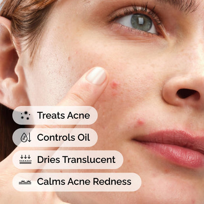 The Ordinary Sulfur 10% Powder-to-Cream Acne Spot Treatment Concentrate, Reduces Pimple Size and Zit Redness, 0.18 Oz
