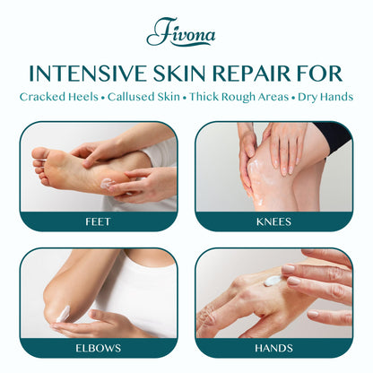 FIVONA 42% Urea Foot Cream for Thick, Rough Dry Skin - Maximum Strength Callus Softening with 2% Salicylic Acid, Tea Tree & Aloe Vera, 100g (3.5 oz) - Deep Moisturizing Foot Care