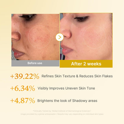 medicube Kojic Acid Turmeric Smoothing Toner for Face & Body | Lightweight Toner for Balancing Uneven Skin Tone & Texture