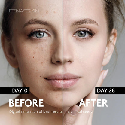 EnaSkin Dark Spot Remover for Face and Body: Advanced Formula Spot Corrector Cream to Fade Age Spots, Sun Spots, Freckles