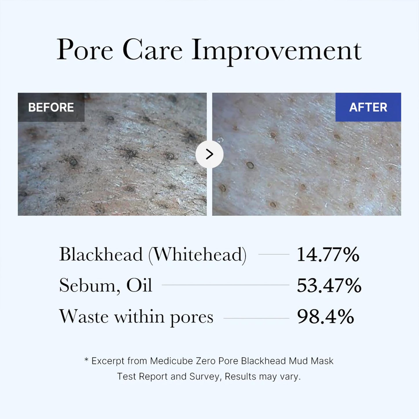 Medicube Zero Pore Blackhead Mud Facial Mask - Skin Cooling & Pore Tightening - 3 Minute Quick Dry Formula with AHA, BHA, PHA