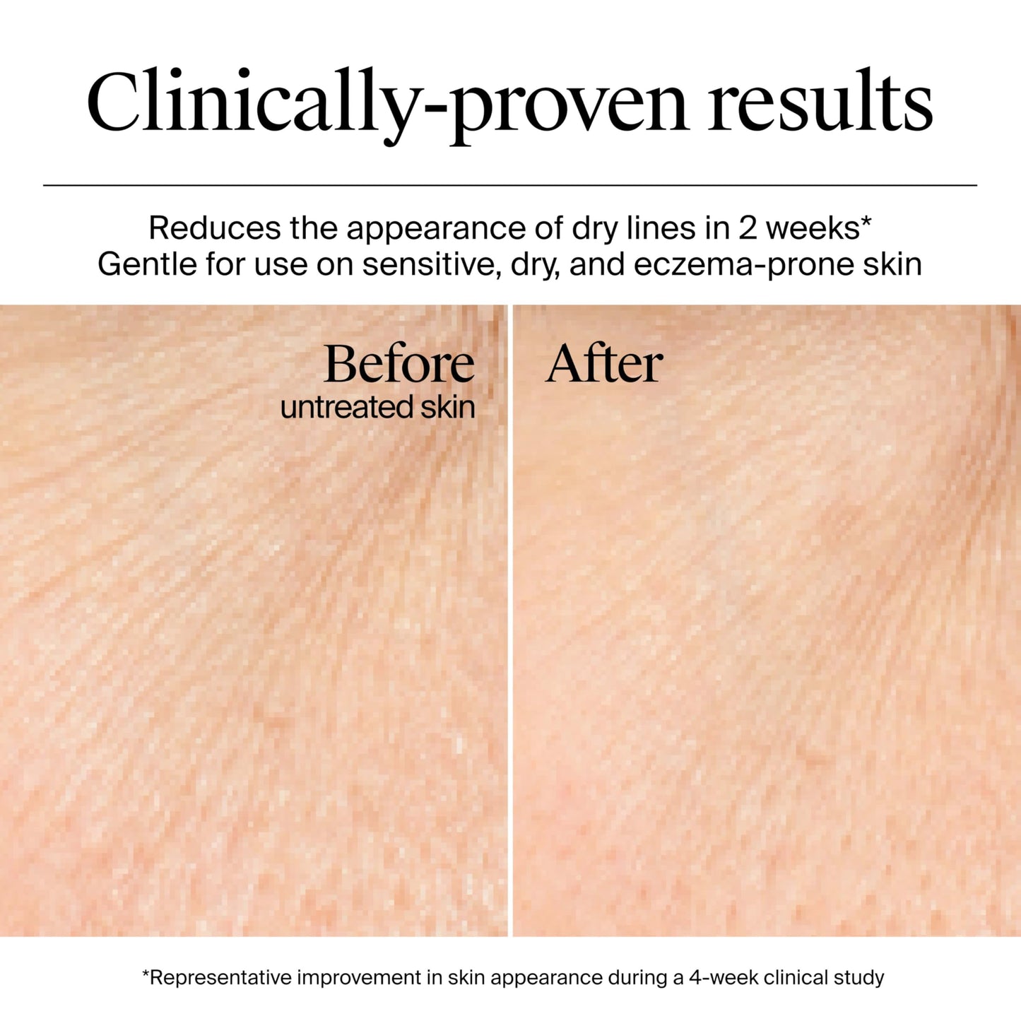 Neutrogena Hydro Boost Gel Cream, 48 Hr Hydration for Normal/Dry Skin, Fragrance Free