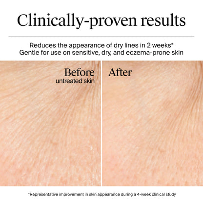 Neutrogena Hydro Boost Gel Cream, 48 Hr Hydration for Normal/Dry Skin, Fragrance Free