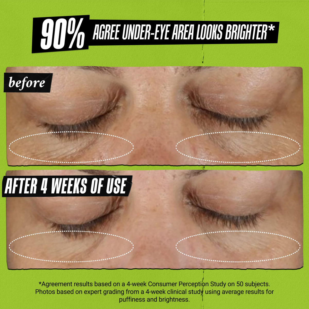 Kiehl's Avocado Eye Treatment, Nourishing and Hydrating Eye Cream, Avocado Oil and Caffeine to Energize and Invigorate Skin, Tired Eyes