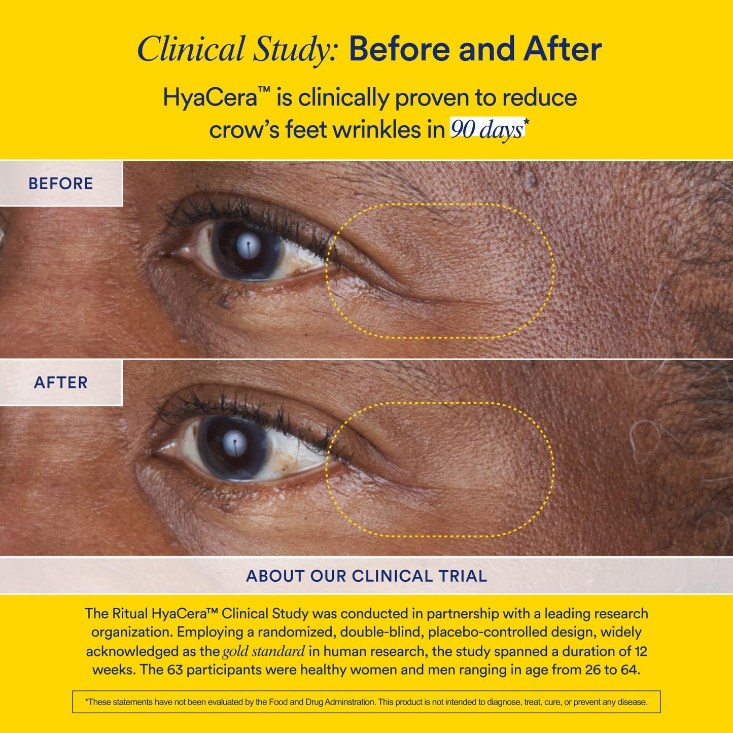 Ritual Hyaluronic Acid Skin Supplement - With Hyabest® and Ceratiq® - HyaCera Clinically Proven to Reduce Wrinkles, Fine Lines & Improve Skin Smoothness