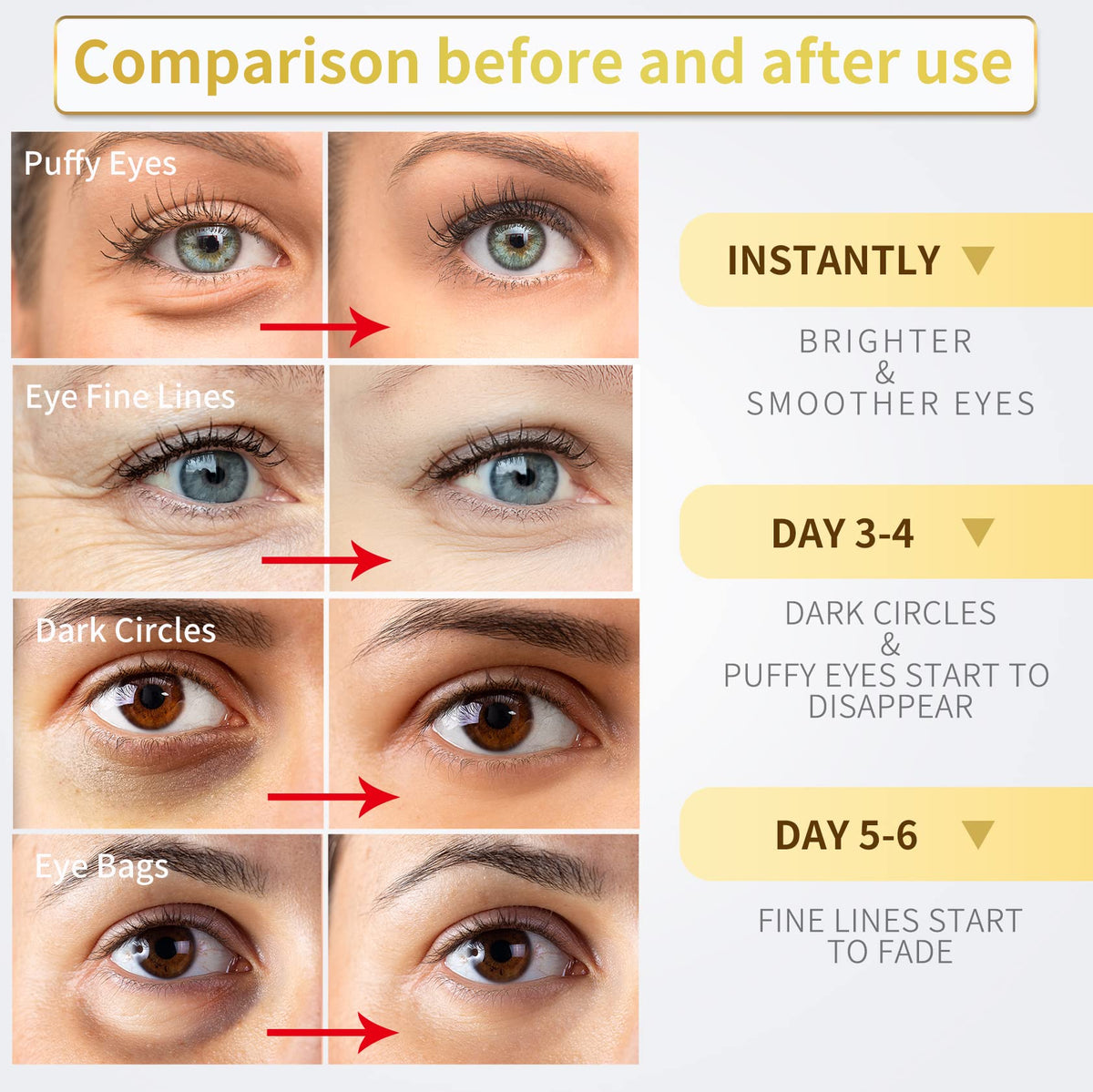 NAZANO 24K Gold Under Eye Patches - 60 Pack for Puffy Eyes, Dark Circles, Bags & Wrinkles
