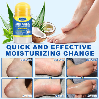 FANSHI 2 PCS Urea Stick 60% High Potency, Foot Care Urea Stick for Deeply Moisturizing & Fast Absorbing, Exfoliation for Dry Cracked Heels & Thickened Skin