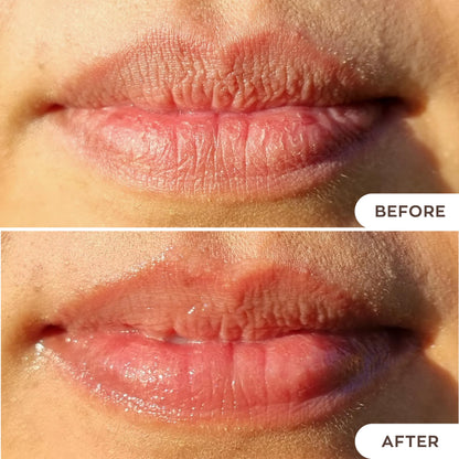 Hanalei Lip Treatment for Dry, Chapped Lips – Intensive Overnight Moisturizer with Kukui Oil